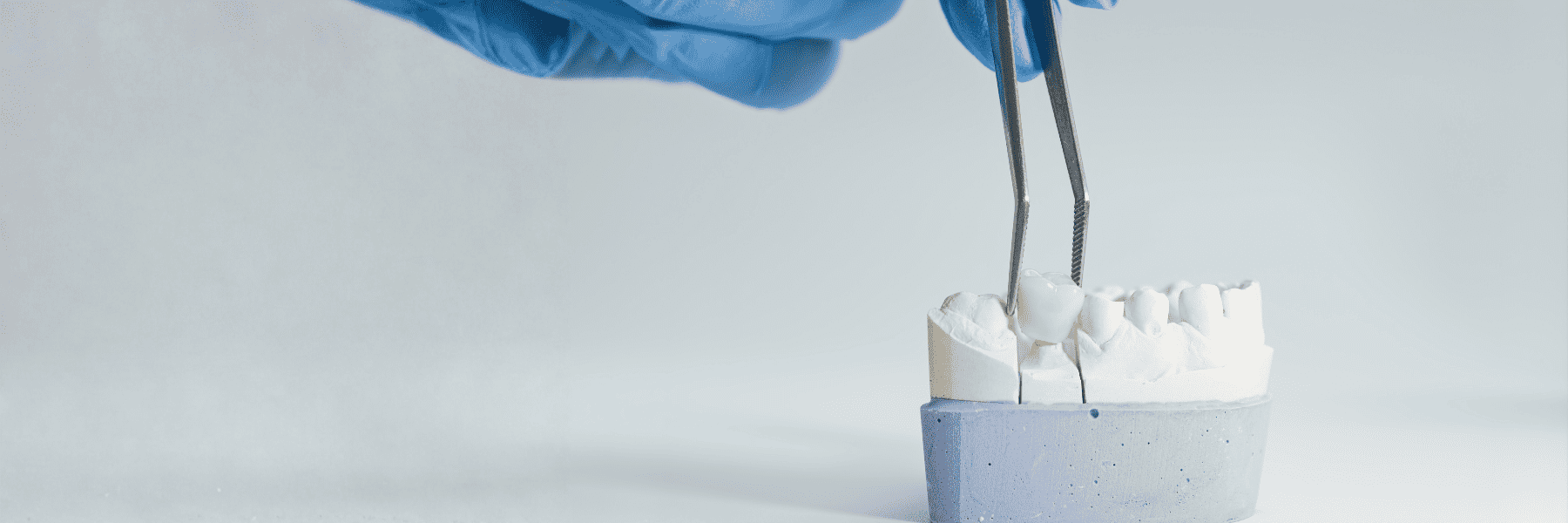 Crowns and Bridges | Dentist